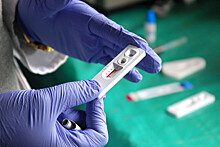 В Италии станет бесплатным лекарство для предотвращения заражения ВИЧ