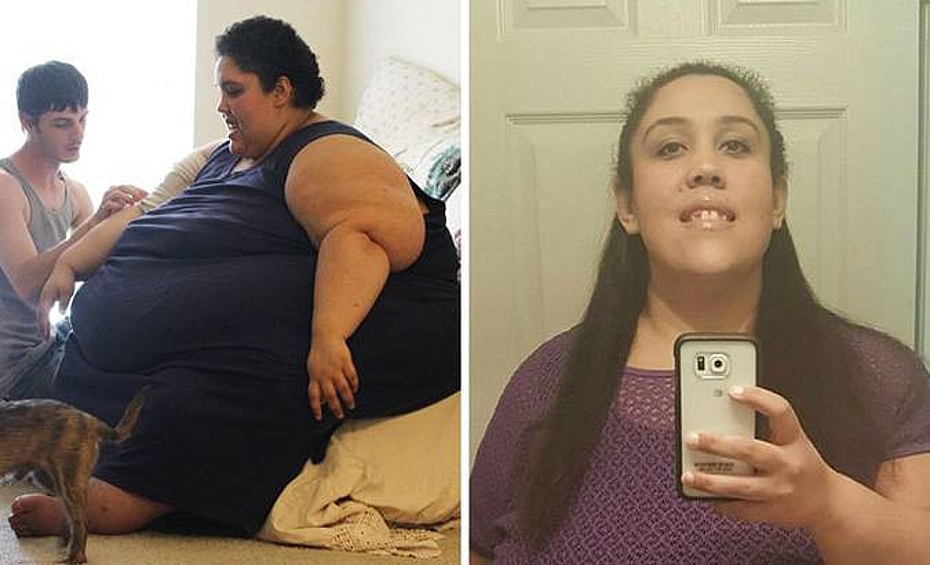 Люди весят 300 кг. Люди весят 300 кг. Брендон скотт я вешу 300 кг. Шунтирование желудка фото до и после. Люди весят 300 кг.