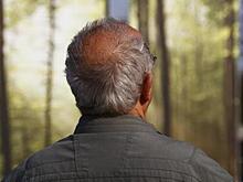 Найдена связь облысения с опасным заболеванием