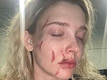 Дочь Кафельникова в ужасе от жестокого избиения российской актрисы: «Уроды! Неадекватные животные»