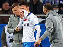 Фуболист "Динамо" получил серьезную травму на матче с "Балтикой"