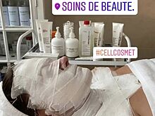 Мария Голубкина: все лицо в бинтах