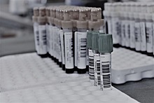 В Пензенской области выявили еще 90 случаев коронавируса