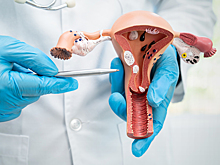 Миома матки: причины, симптомы, лечение