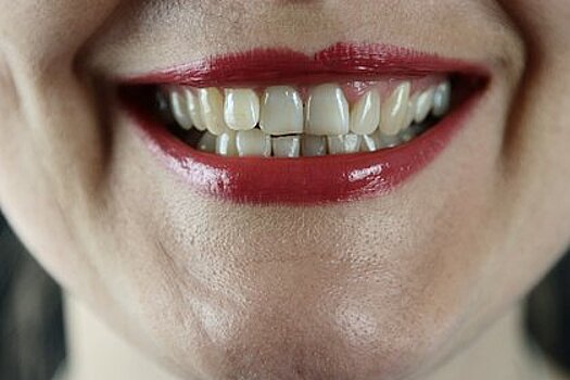 Стоматолог назвал не связанные с едой причины пожелтения зубов