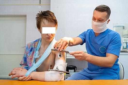 В Кирове врачи пришили руку молодому человеку из Зуевки