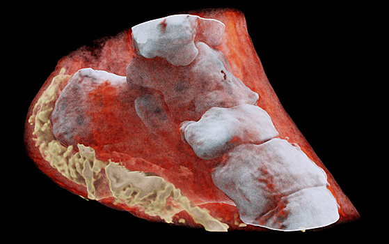 Человека впервые просканировали «цветным» рентгеном