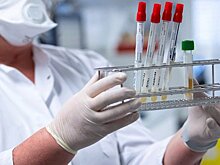 41 вологжанин заразился COVID-19 за сутки