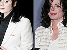 9 человек, которые изуродовали себя, желая стать похожими на звезд