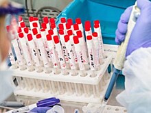В Мурманской области за сутки выявлено 87 случаев COVID-19