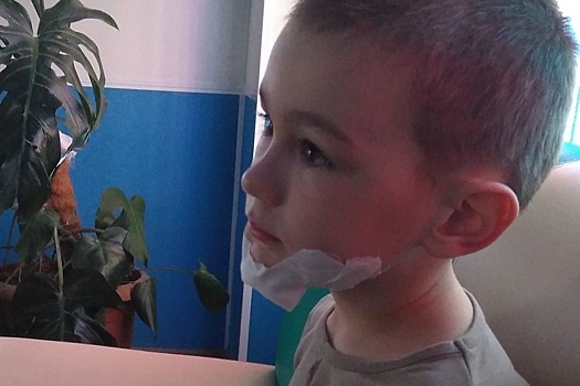 Подаренный Натальей Водяновой тренажер изуродовал лицо ребенку в центре Волгограда