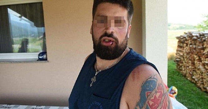 В Хорватии на курорте избили серба за крест, кириллицу и красную звезду