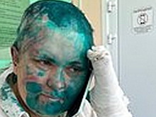 Избитая в Чечне журналистка Милашина пообещала вновь поехать в Грозный
