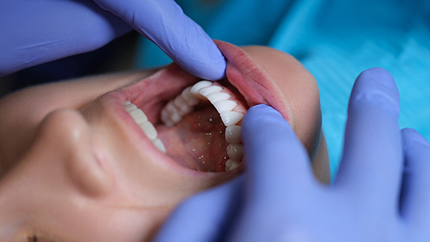 Стоматолог рассказал, как сэкономить на лечении зубов