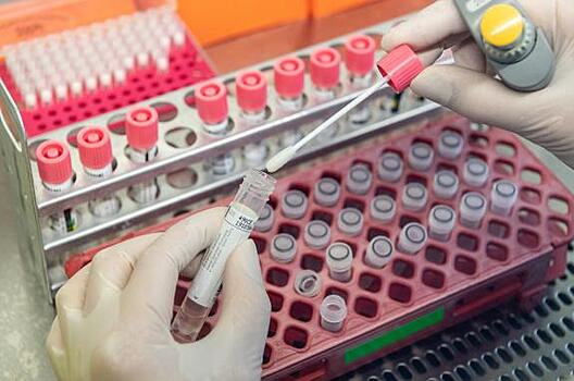 Специалист по инфекциям оценил информацию о распространении коронавируса по "поясу смерти"