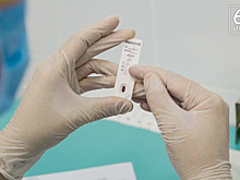 Минздрав назвал противопоказания к прививке от коронавируса