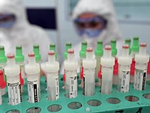 Скворцова объяснила трудности с вакциной от коронавируса