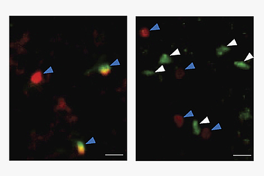 Найден способ победить старение мозга