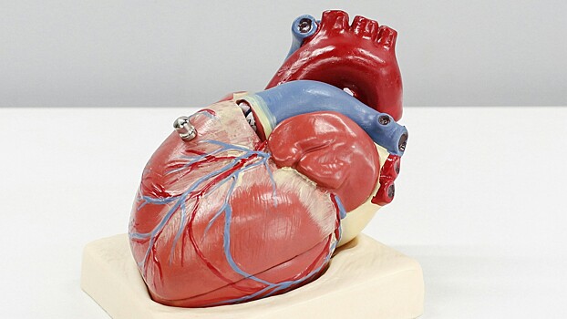 Российские ученые научились помогать сердечникам с использованием ИИ