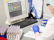 Новосибирские учёные предложили новый способ ранней диагностики рака лёгких