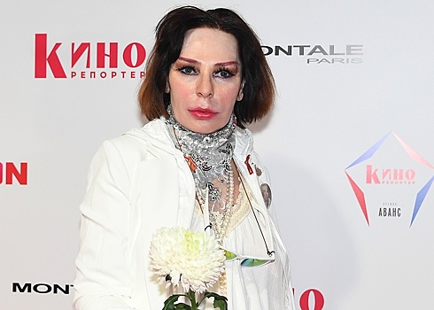 Звезды, которые изуродовали себя пластическими операциями - 7Дней.ру