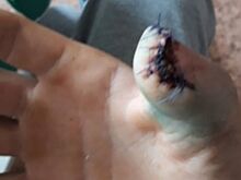 В Златоусте работодатель не хочет выплачивать компенсацию бывшему работнику, лишившемуся пальца на производстве