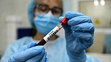 Иммунолог назвал условие для вакцинации от коронавируса