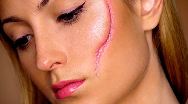 Как избавиться от шрамов на лице