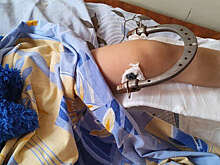 На Алтае мальчик сломал ногу из-за резкого торможения автобуса