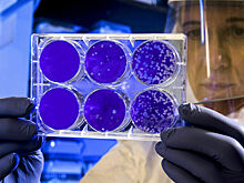 В ВОЗ назвали версию о естественном происхождении COVID-19 «все более вероятной»