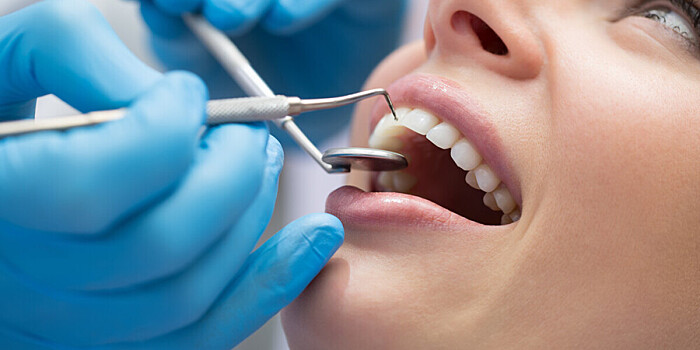 Названы причины повышенной чувствительности зубов