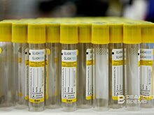 ДНК расскажет об измене и депрессии: как россияне стали чаще обращаться к гентестам за правдой