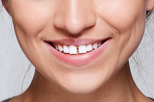 Ортодонт Жук: Промежуток между передними зубами может влиять на дикцию