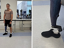 Участник СВО из Волгограда получил протез стоимостью почти 1,3 млн рублей