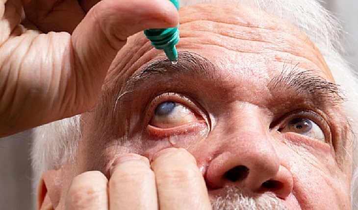 Появились первые в мире капли для лечения катаракты
