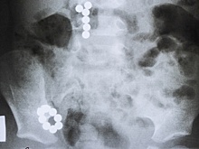 Эстонский политик пообещал не допустить перевода русских школ страны на эстонский язык