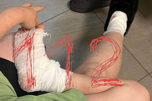 В Приморье соседская собака напала на женщину и ее ребенка