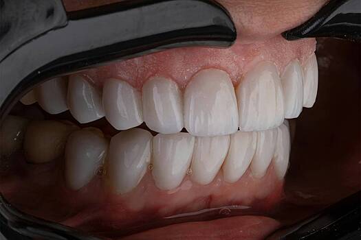 Врач назвала скрытую причину набора веса