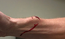 Смертельный яд змеи попадает в кровь: эксперимент ученых