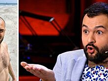 Шевелюра ушла. Облысевшие звёзды