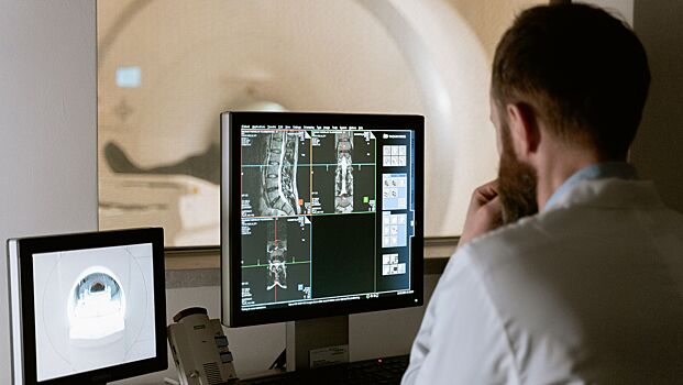 Ортопед назвала два явных признака развития остеопороза