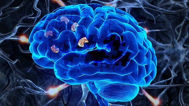 Neurology: учеными из США найден ранний признак болезни Альцгеймера