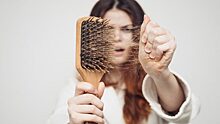 Как защитить волосы от выпадения, вологжане узнают по «телефону здоровья»