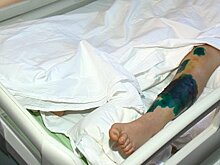 В Пензе попавшей в ДТП студентке провели уникальную операцию