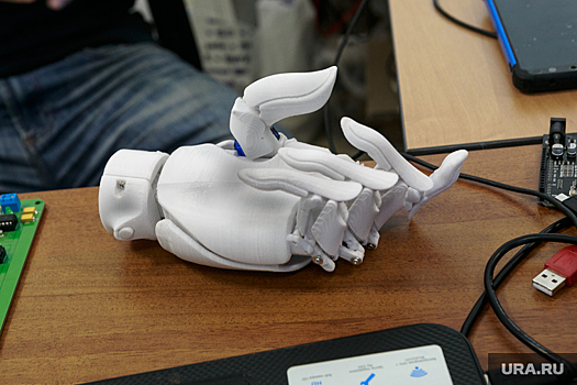 В больнице Сургута впервые установили протез, напечатанный на 3D-принтере