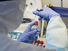 В Германии зафиксировали более 67 тысяч случаев заболевания COVID-19