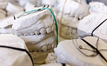 Антрополог считает, что люди лишатся зубов мудрости
