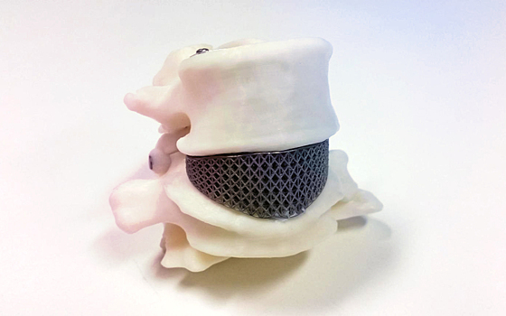 Нейропротезы напечатали на 3D-биопринтере