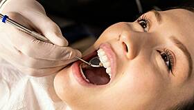 Стоматолог назвала способы избежать лишних пломб