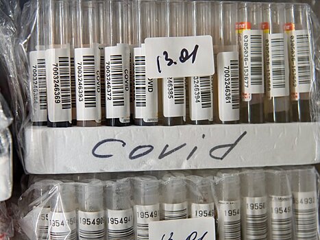 НИИ имени Пастера подал заявку на регистрацию кожного теста на антитела к коронавирусу